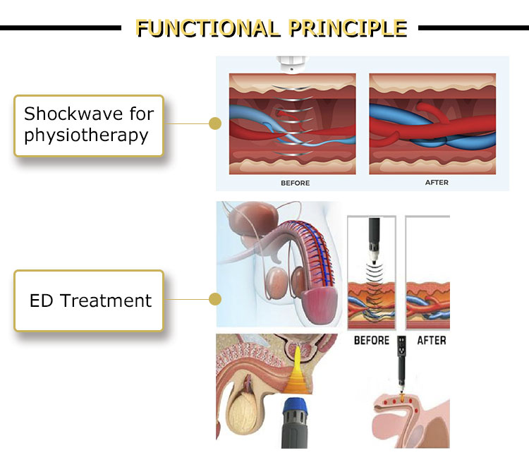RF02 Smart tecar wave 14